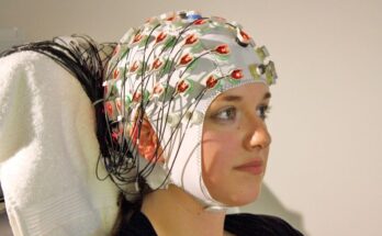 Global Electroencephalography Devices Market